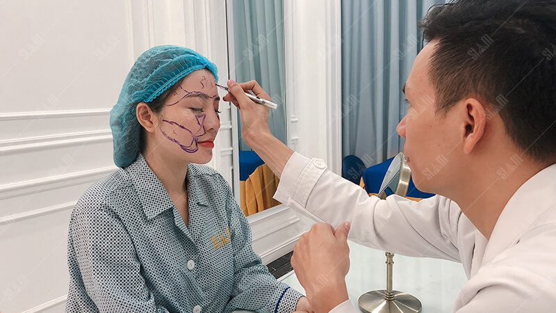 Các bác sĩ có kỹ năng chuyên môn cao trong việc cấy mỡ mặt