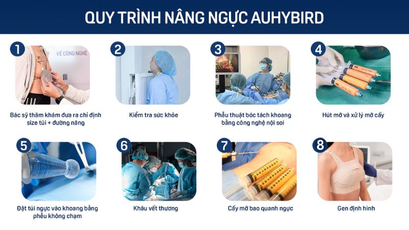 Quy trình các bước nâng ngực Au-hybrid tại Siam