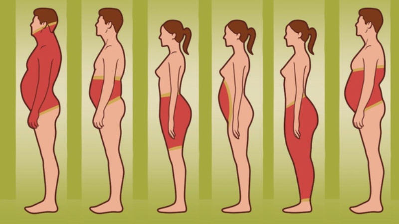 Mỡ thừa tích tụ nhiều ở vùng bụng, hông, đùi là dấu hiệu cho béo phì