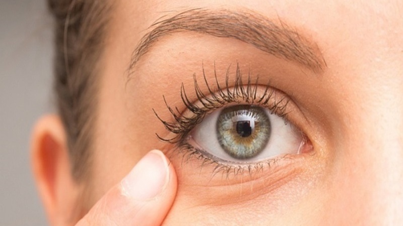 Hiệu quả thẩm mỹ của phương pháp cấy mỡ mắt tùy thuộc vào mỗi người