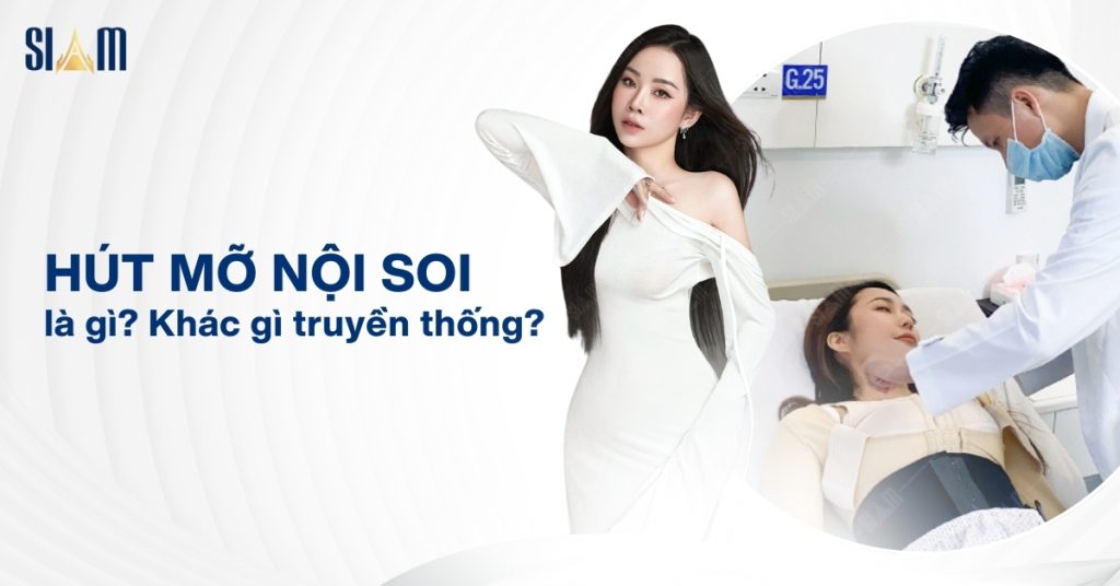 Hút mỡ nội soi là gì