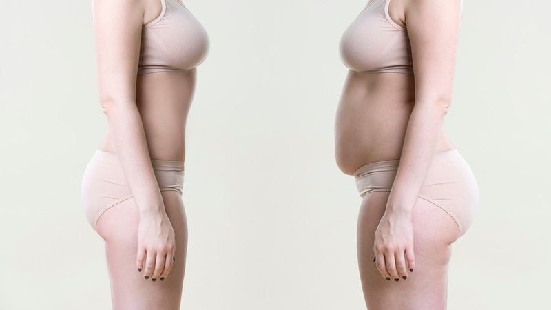Hút mỡ bụng có thể duy trì lâu dài nếu có chế độ sinh hoạt lành mạnh