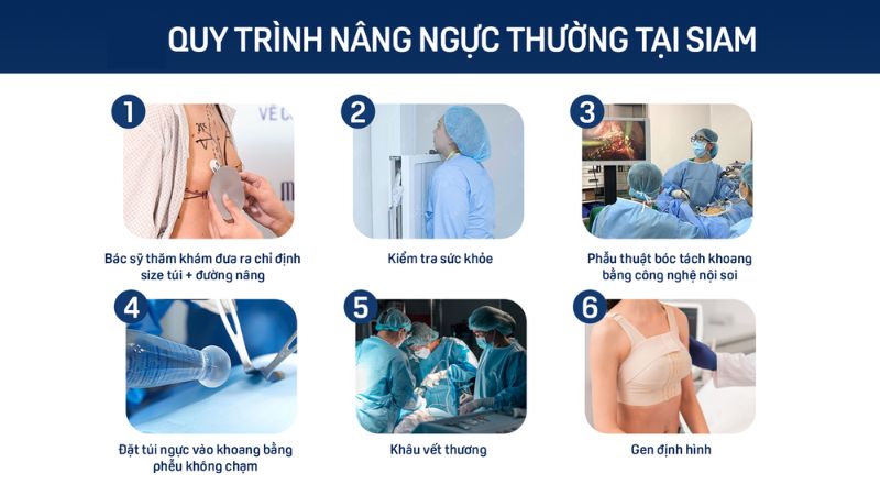 Quy trình các bước nâng ngực tại Siam