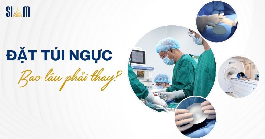 Đặt túi ngực bao lâu phải thay? Cách duy trì tuổi thọ túi ngực