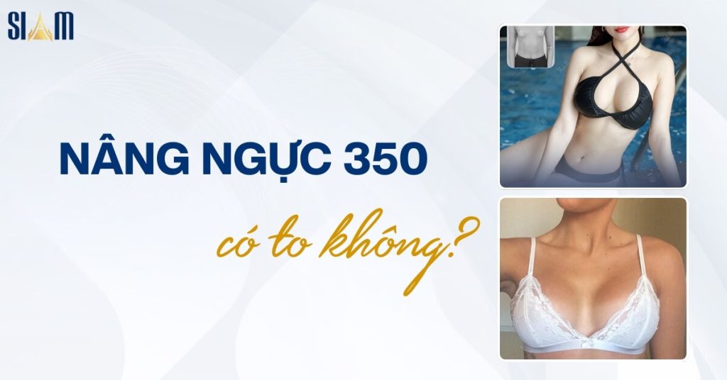 Nâng ngực size 350 có to không? Phù hợp với đối tượng nào?