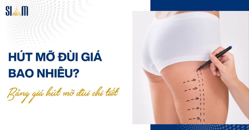 Hút mỡ đùi giá bao nhiêu? Bảng giá hút mỡ đùi chi tiết
